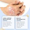 Laniska Bee Venom Skin Care Spray Moisturizes Skin And Restores Daily Care Topical Spray
