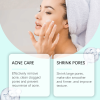 Hoygi Azelaic Acid Acne Cream, Oil Control Gentle Moisturizing Acne Skin Moisturizing Daily Facial Cream