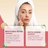 Jaysuing Day And Night Facial Acne Patch Facial Skin Oil Control & Clear Mild Acne Cleansing Patch
