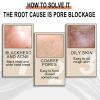 Jaysuing Lactose Solution, Exfoliate Blackheads Shrink Pores Clean And Moisturize SkinEssence