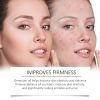 OUHOE Retinol Essence Oil, Facial Acne Skin Nourishing Elastic Hydrating Moisturizing Skin Care Essence