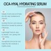Hoygi Hyaluronic Acid Moisturizing Essence, Moisturizing and Soothing Skin, Long-lasting Hydration, Alleviating Dryness