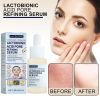 Jaysuing Lactose Solution, Exfoliate Blackheads Shrink Pores Clean And Moisturize SkinEssence