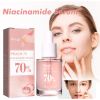 Hoygi Nicotinamide Essence Tights And Moisturizes Pores, Lighens Acne Marks And Spots, Moisturizes And Brighens Skin