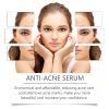 Hoygi Nicotinamide Serum Mild Serum Acne Moisturizing Serum