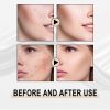 Jaysuing Lactose Solution, Exfoliate Blackheads Shrink Pores Clean And Moisturize SkinEssence