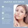OUHOE Acne-Clearing Serum Gently Nourishes Facial Skin, Tightens Pores And Removes Acne