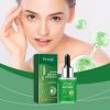 Hoygi Moisturizing Essence Moisturizes Facial Skin, s Skin Elasticity, Rejuvenates Skin And Rejuvenates