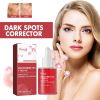 Hoygi Dark Spots Essence, Moisturizing And Brightening Essence For Dark Spots And Age Spots